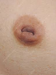 Inverted Nipple in Breast Cancer 